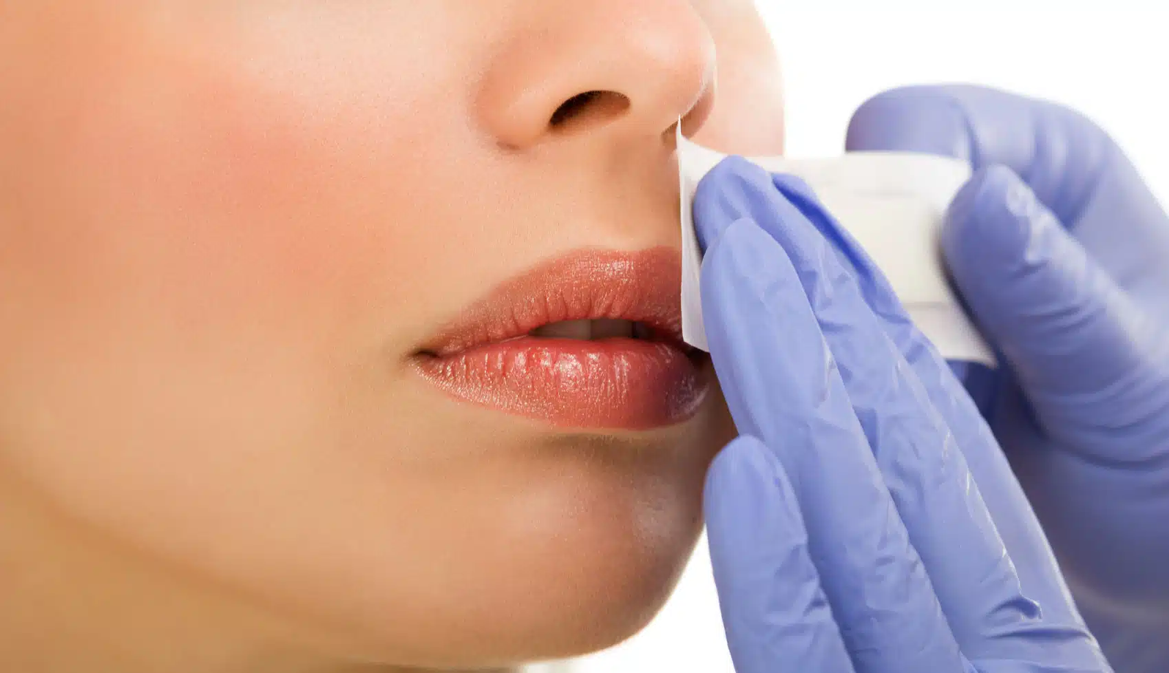 Boven onderlip en kin harsen Schoonheidssalon VitaCare Health & Beauty Almere