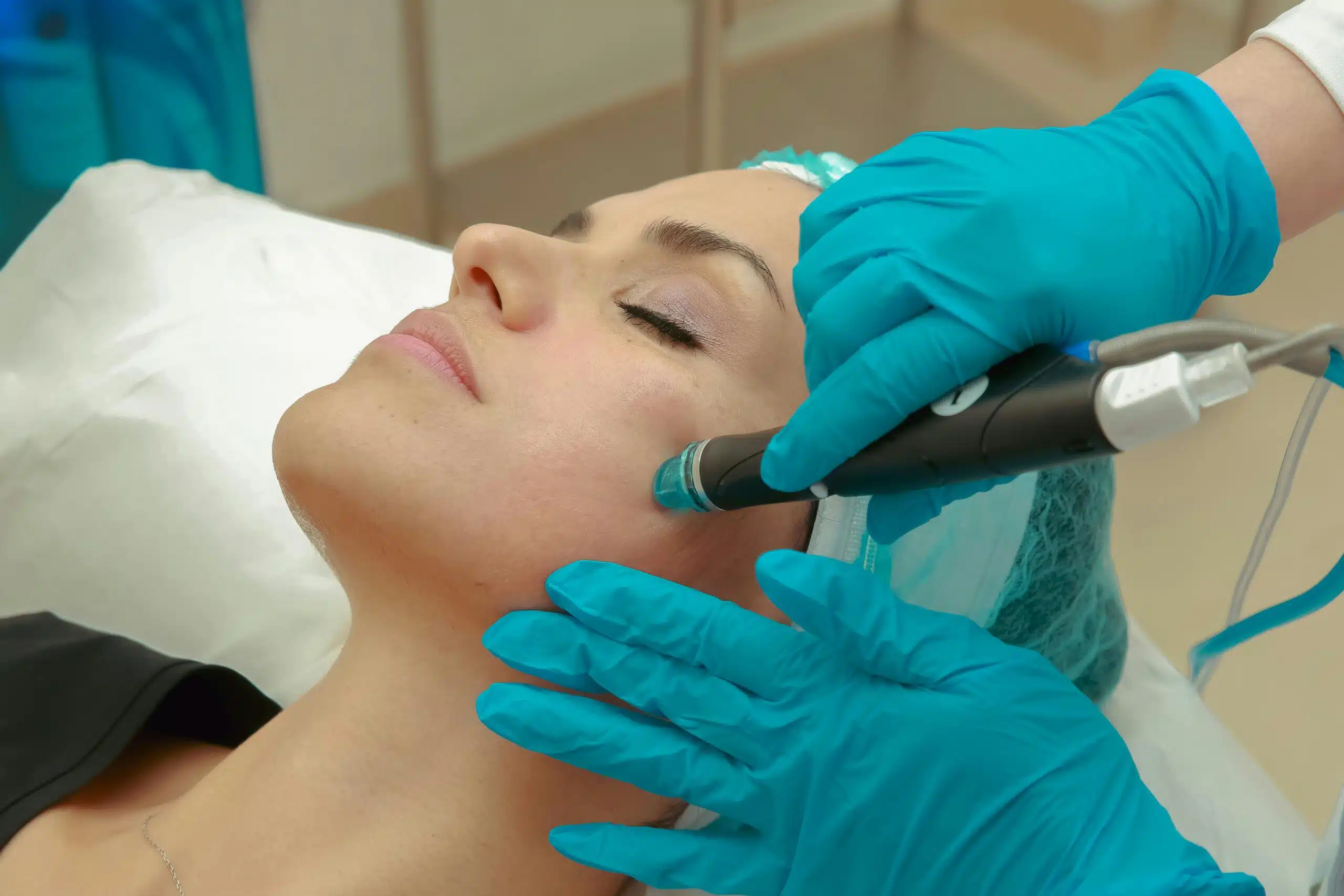 Hydrafacial Almere – Ervaar direct zichtbaar resultaat bij VitaCare